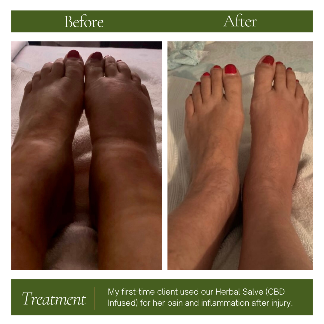 Herbal Salve — New Look + Upgraded Formula - Joint & Muscle Salve