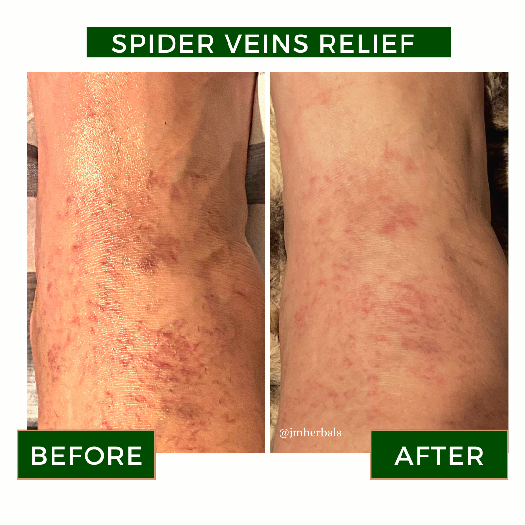 Organic Calendula Healing Salve for Diaper Rash, Eczema, Stretch Marks, & Nipple Care – All-Natural Remedy for Sensitive Skin