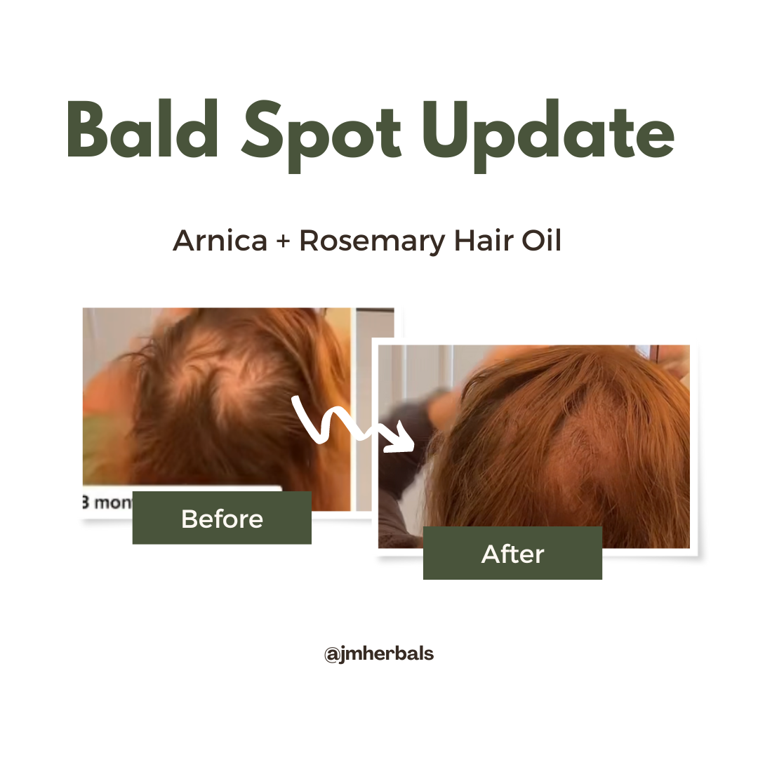 Hair Growth Bundle
